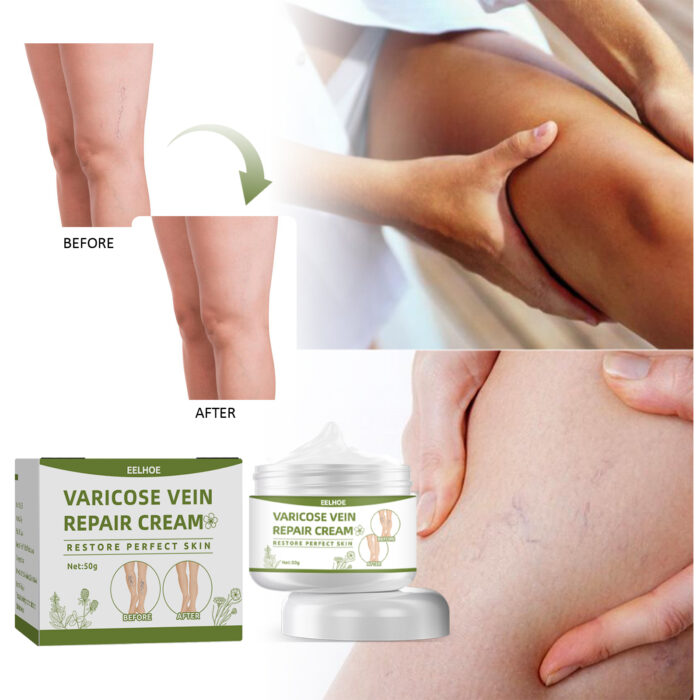 Leg Repair Cream Relieves Leg Discomfort Massage Leg Repair Cream For Raised Veins - Image 3