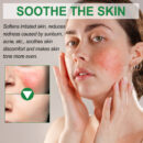 Color Correction Treatment Cream, Lighten Spots After Sun Repair Moisturizing Skin Beauty Cream