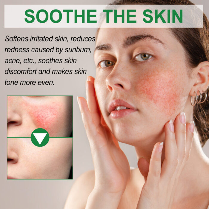 Color Correction Treatment Cream, Lighten Spots After Sun Repair Moisturizing Skin Beauty Cream - Image 5