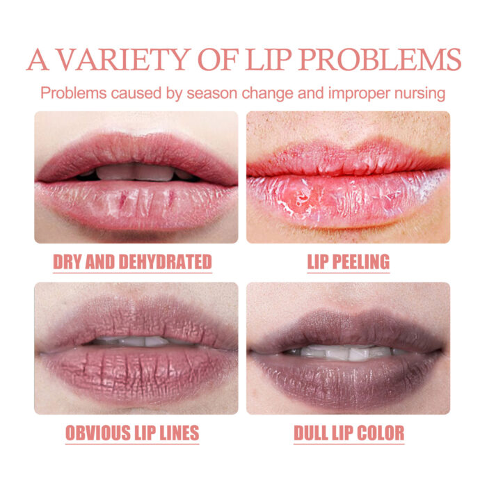 Exfoliates Dead Skin Bubble Lip Mask, Lightening Lip Lines Softening Horny Skin Moisturizing And Preventing Dry Cracking Lip Mask - Image 5