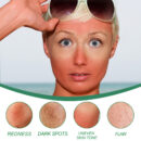 Color Correction Treatment Cream, Lighten Spots After Sun Repair Moisturizing Skin Beauty Cream