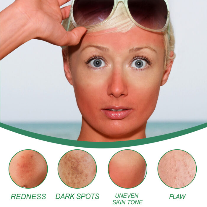 Color Correction Treatment Cream, Lighten Spots After Sun Repair Moisturizing Skin Beauty Cream - Image 4