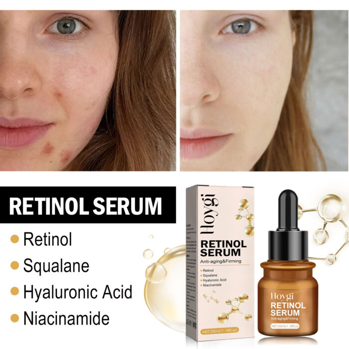 Retinol Anti-Wrinkle Essence Reduces Fine Lines, Firming, Moisturizing And Brightening Anti-Aging Essence - Image 5