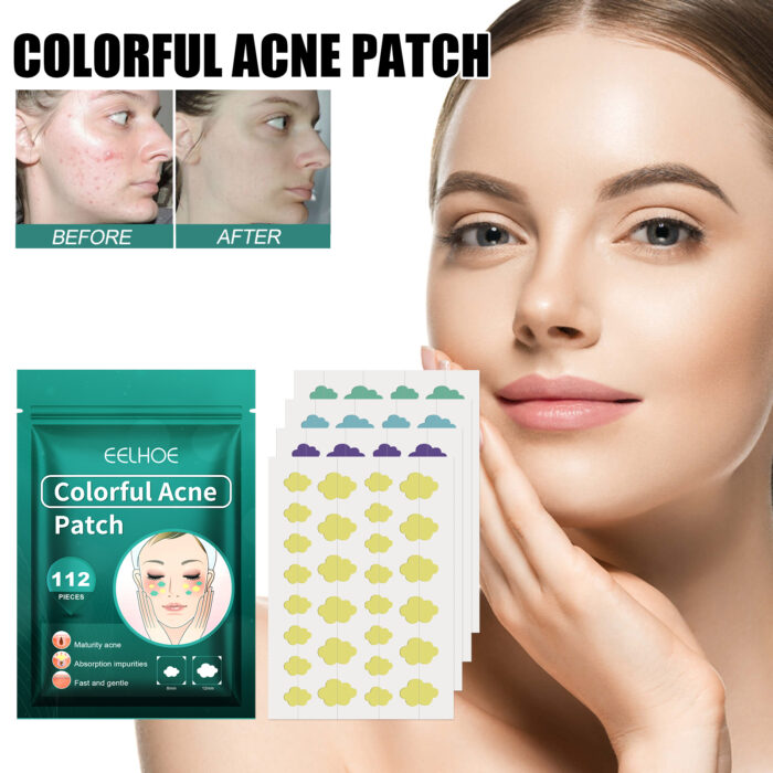 Colorful Acne Patch, Repair Pit Acne Print Smooth Skin Lightening Spot Clear Acne Facial - Image 3