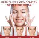 Retinol Whitening Fine Line Cream Moisturizing, Whitening, Firming, Moisturizing And Deep Hydrating Cream