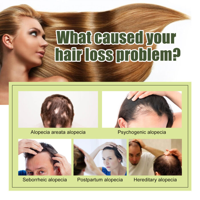 Hair Boosting Serum, Preventing Hair Loss And Repairing Dry And Frizzy Hair Soft And Moist Dense Hair Oil - Image 5