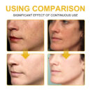 V7 Whitening Cream Reduces Wrinkles And Fine Lines On The Face, Moisturizes And Brightens Skin, Anti-Aging And Replenishing Cream