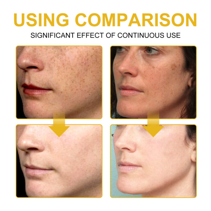 V7 Whitening Cream Reduces Wrinkles And Fine Lines On The Face, Moisturizes And Brightens Skin, Anti-Aging And Replenishing Cream - Image 5