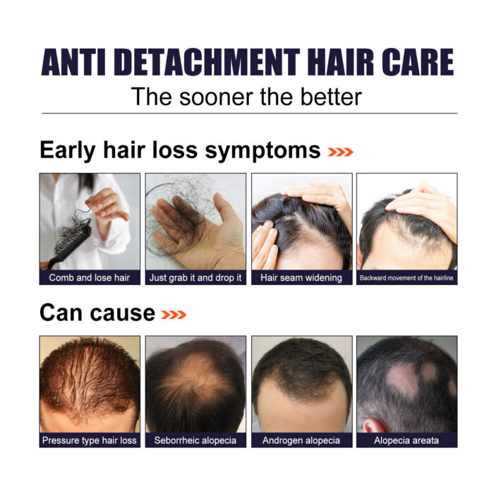 Herbal Hair Essence, Moisturizes Scalp Strong Hair Roots Thick Beard Care Essence - Image 4