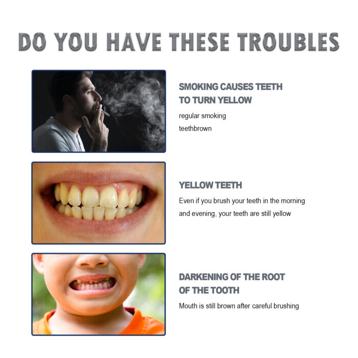 Teeth Whitening Essence Pen, Teeth Cleaning Care Fresh Breath Remove Smoke Stains Teeth Whitening Teeth Cleaning Pen - Image 4