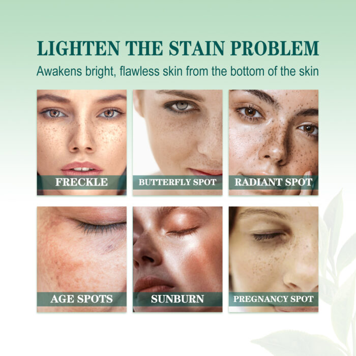 Brightening Blemish Essence, Lightening Melasma Blemish Hydrating And Brightening Skin Essence - Image 5