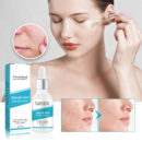 Salicylic Acid Exfoliating Essence, Deep Clean Skin Pores Exfoliate And Moisturize Essence